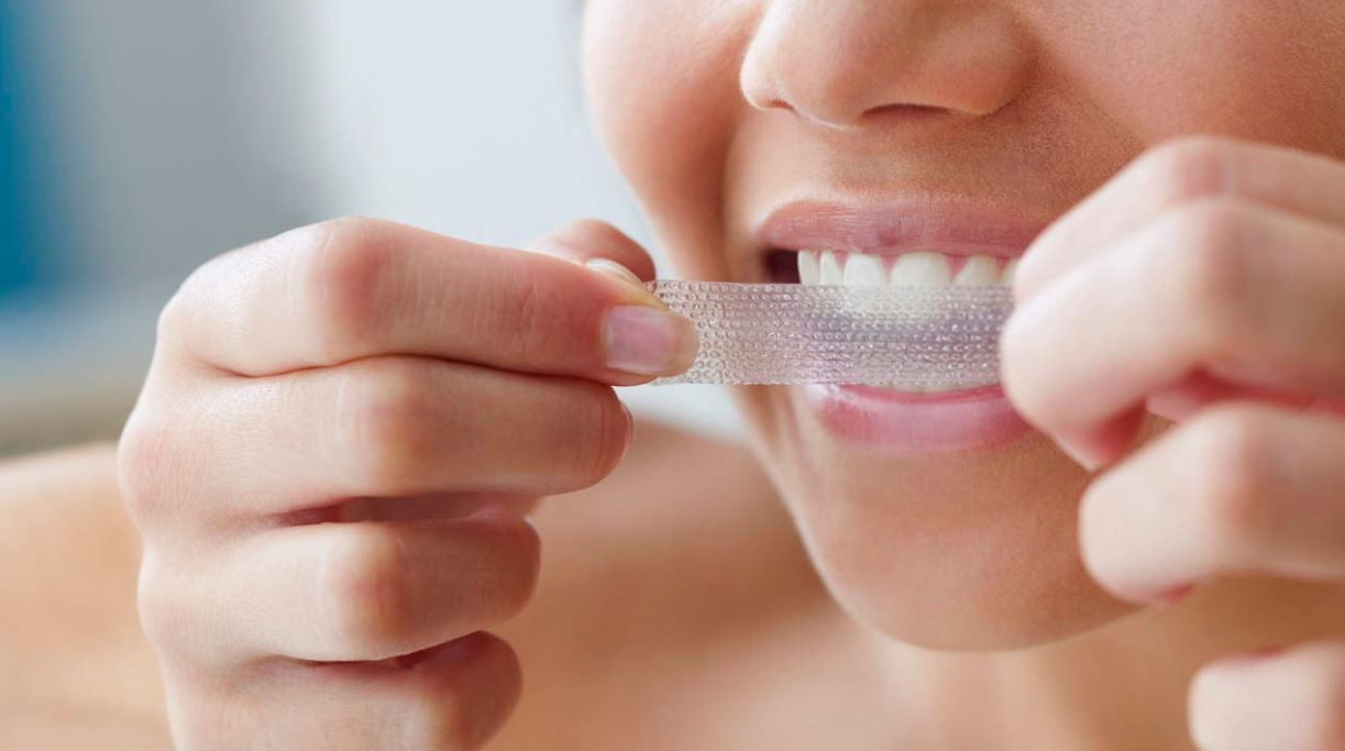 dental whitening
