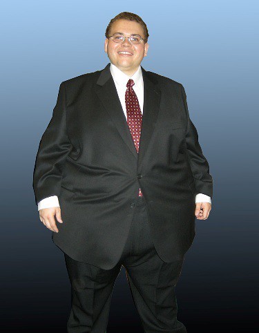 obese man